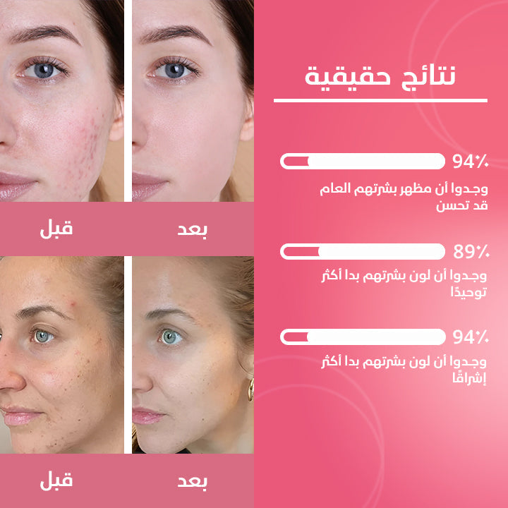 الكركم وحمض الكوجيك