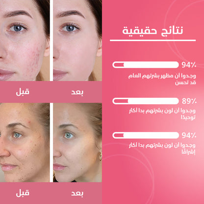 الكركم وحمض الكوجيك